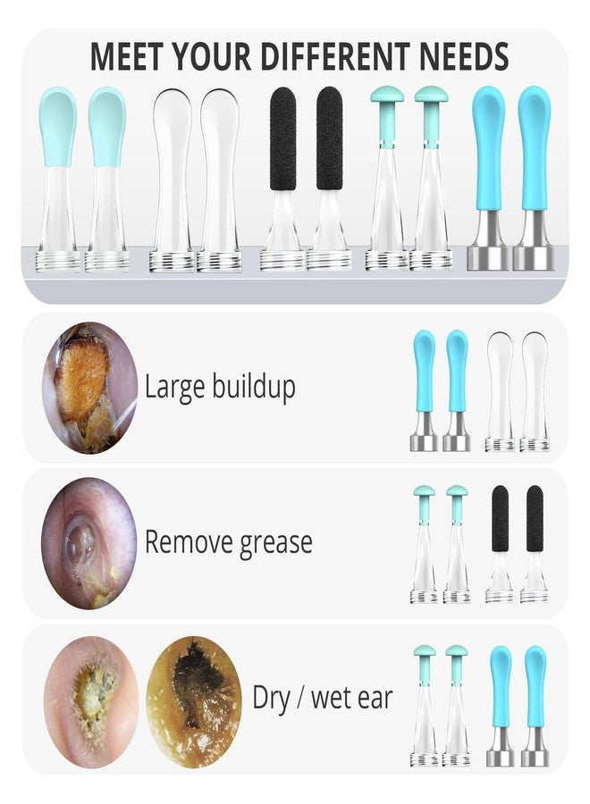 BEBIRD Official R1 Original Accessory - 10 PCS Replacement Tip for Wet/Dry Wax Cleaning - Ear Spoons Accessories Set Compatible with BEBIRD R1/M9/R3/X3/W3/D3Pro/T15/C3 (New Spiral Structure!) - Image 3